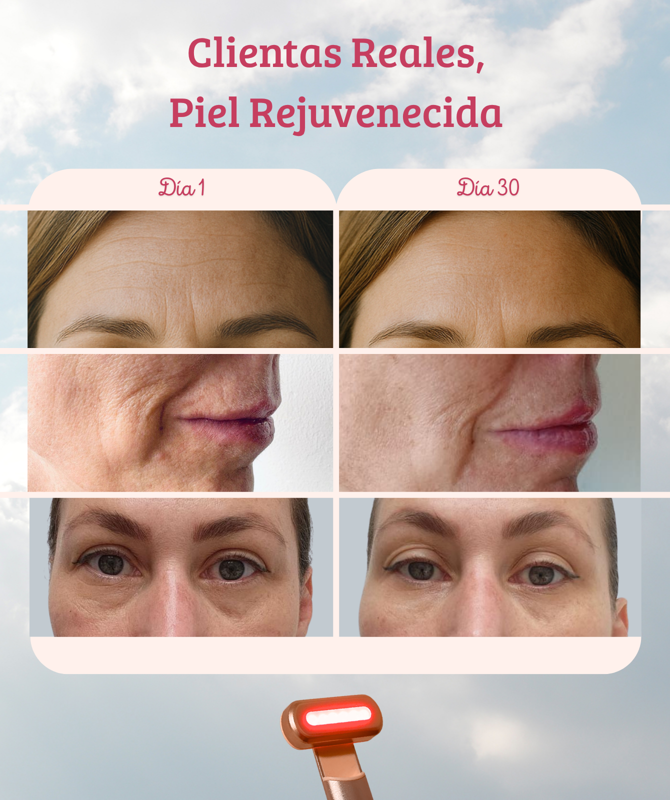 Dispositivo de Rejuvenecimiento Facial LumaSkin