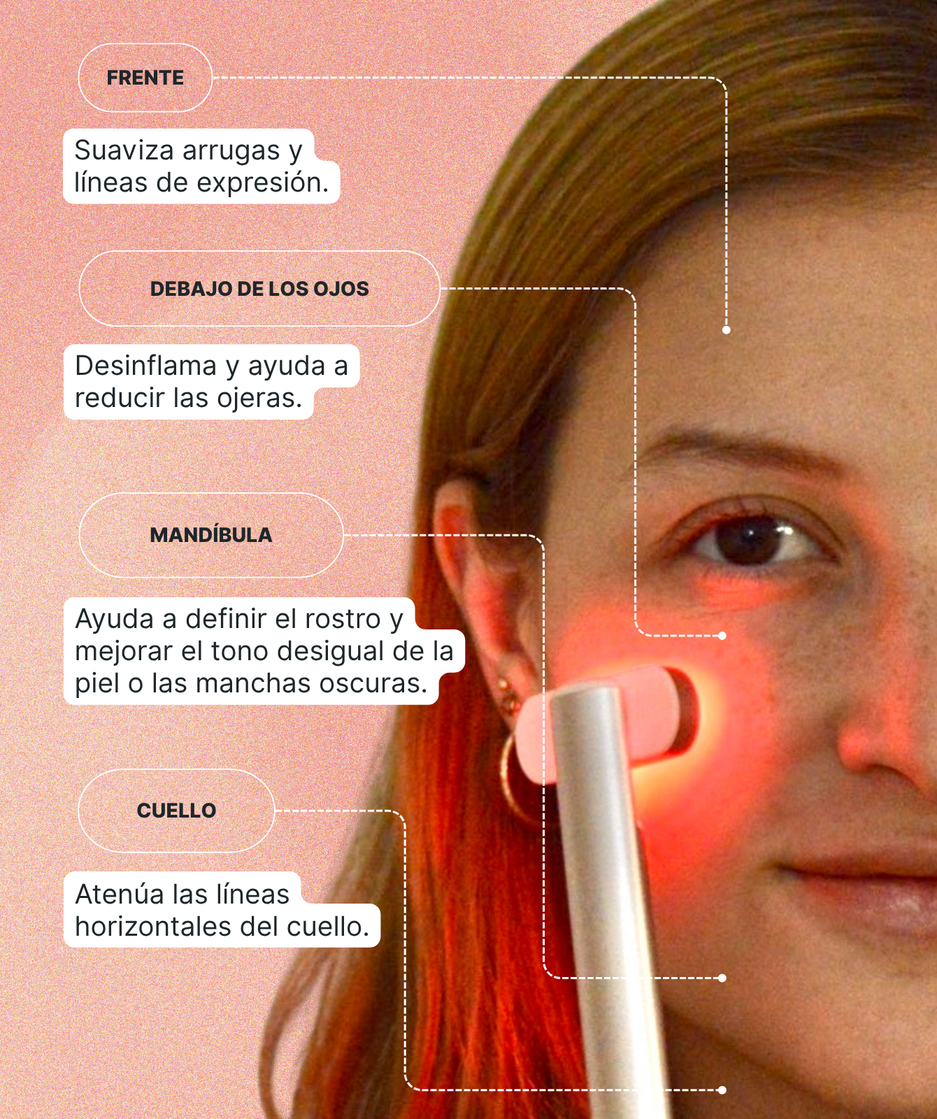 Dispositivo de Rejuvenecimiento Facial LumaSkin