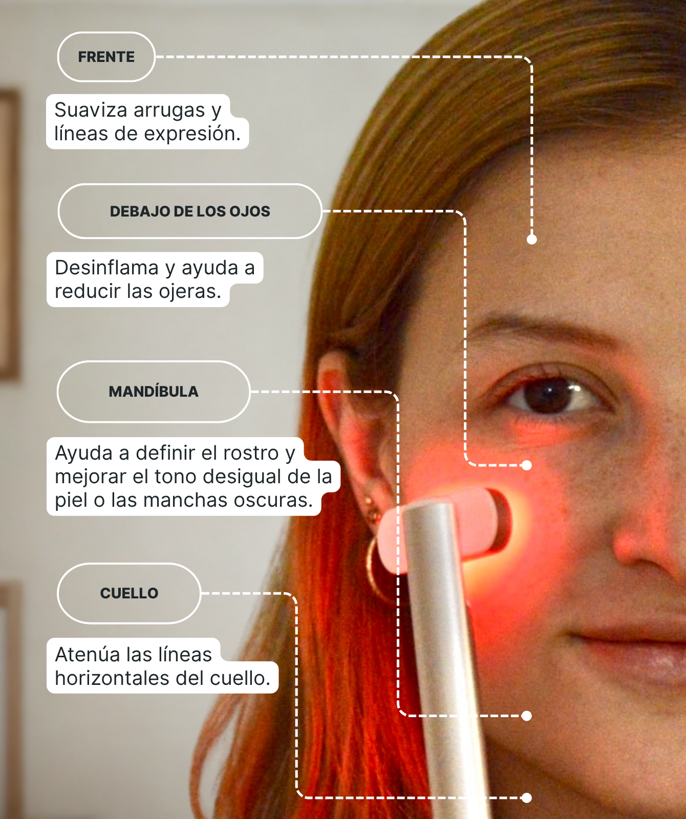 Dispositivo de Rejuvenecimiento Facial LumaSkin