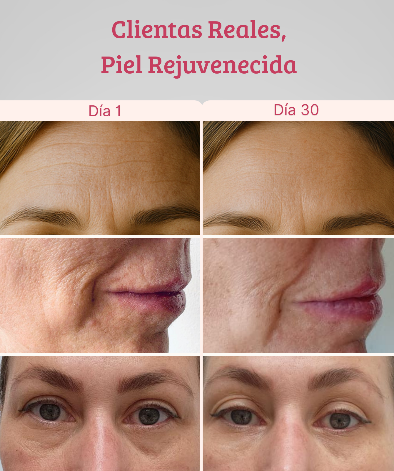 Dispositivo de Rejuvenecimiento Facial LumaSkin
