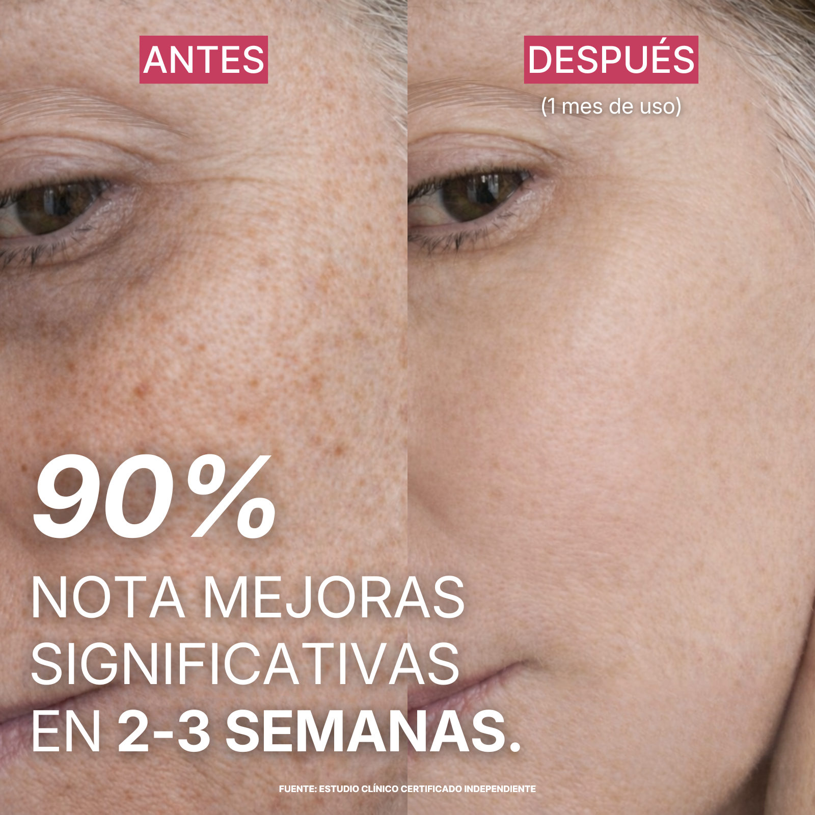 Varita LumaSkin 5-en-1